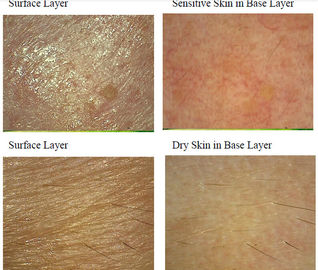 دستگاه آنالایزر پوستی Uv پوست برای پوست موی / چربی / چروک / رنگدانه