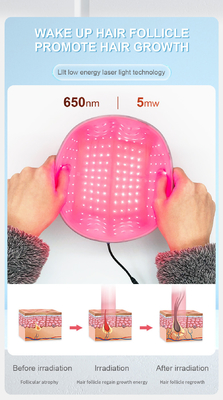 کلاهک لیزری 650 نانومتری Lllt Red Light Therapy Cap Laser 200 Diode Hair Hair Helmet رشد مو با لیزر