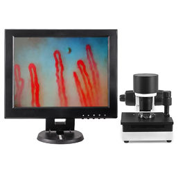 میکروسکوپ گردش خون مویرگی خون 600X خروجی بزرگنمایی DC12V 2A