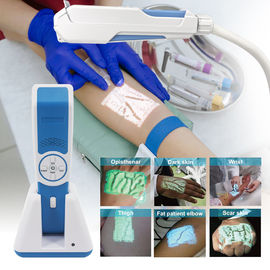 ابزار کلینیک قابل حمل دستگاه طب سوزنی وین با دقت 25/0 میلی متر CE