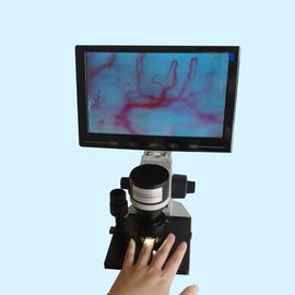 دستگاه تست میکروسیرکولر رنگ LCD صفحه نمایش صفحه اصلی بیمارستان بالینی
